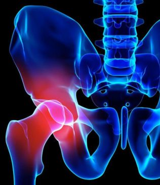 Preparing for Hip Replacement Surgery: A Practical Checklist