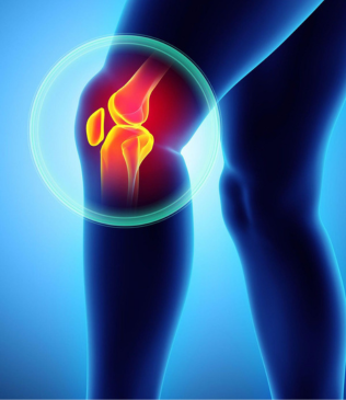When Knee Pain Isn't Arthritis: Other Common Causes